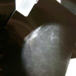 Una radiografia durant una visita a l'especialista